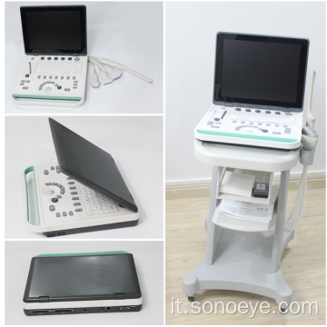 Scanner per ultrasuoni bianco nero laptop 2D